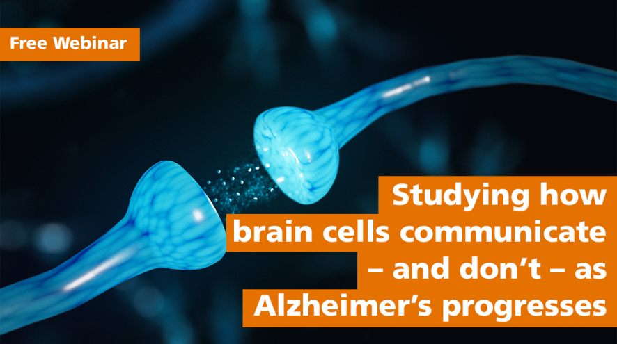 Free Webinar - Studying how brain cells communicate -- and don't -- as Alzheimer's progresses.