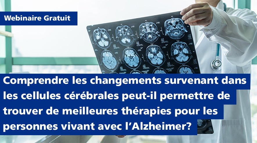 Comprendre les changements survenant dans les cellules cérébrales peut-il permettre de trouver de meilleures thérapies pour les personnes vivant avec l’Alzheimer?