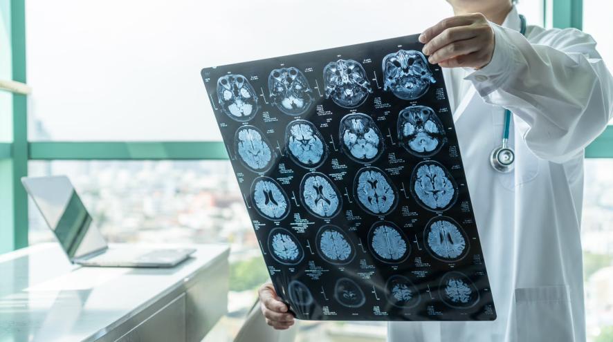 A scientist holding a set of brain scan images